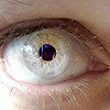 Eye White on My World.